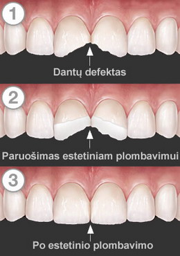 Estetinė odontologija